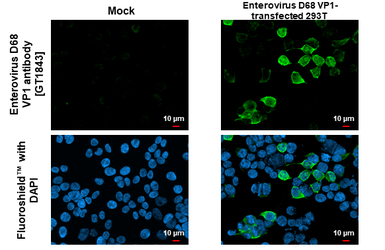 Anti-Enterovirus D68 VP1 antibody [GT1843] used in Immunocytochemistry/ Immunofluorescence (ICC/IF). GTX633770